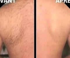 Épilations Soins Esthétique 57 123 888